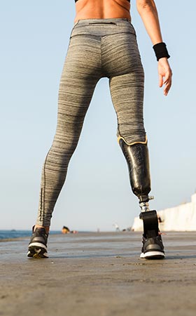 Prosthetic leg woman